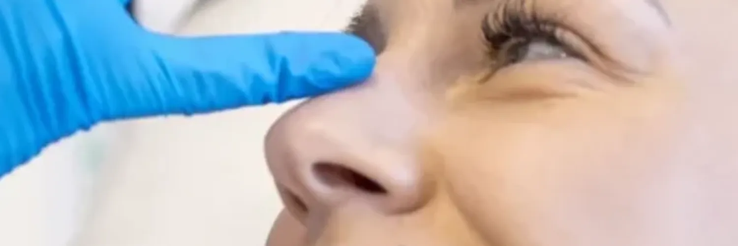 HOW LONG DOES BOTOX LAST?