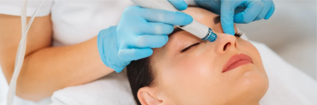 10 Surprising Benefits Of Microneedling Treatments